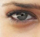 Отеки под глазами, аллергия могут быть причинами появления морщин под глазами.